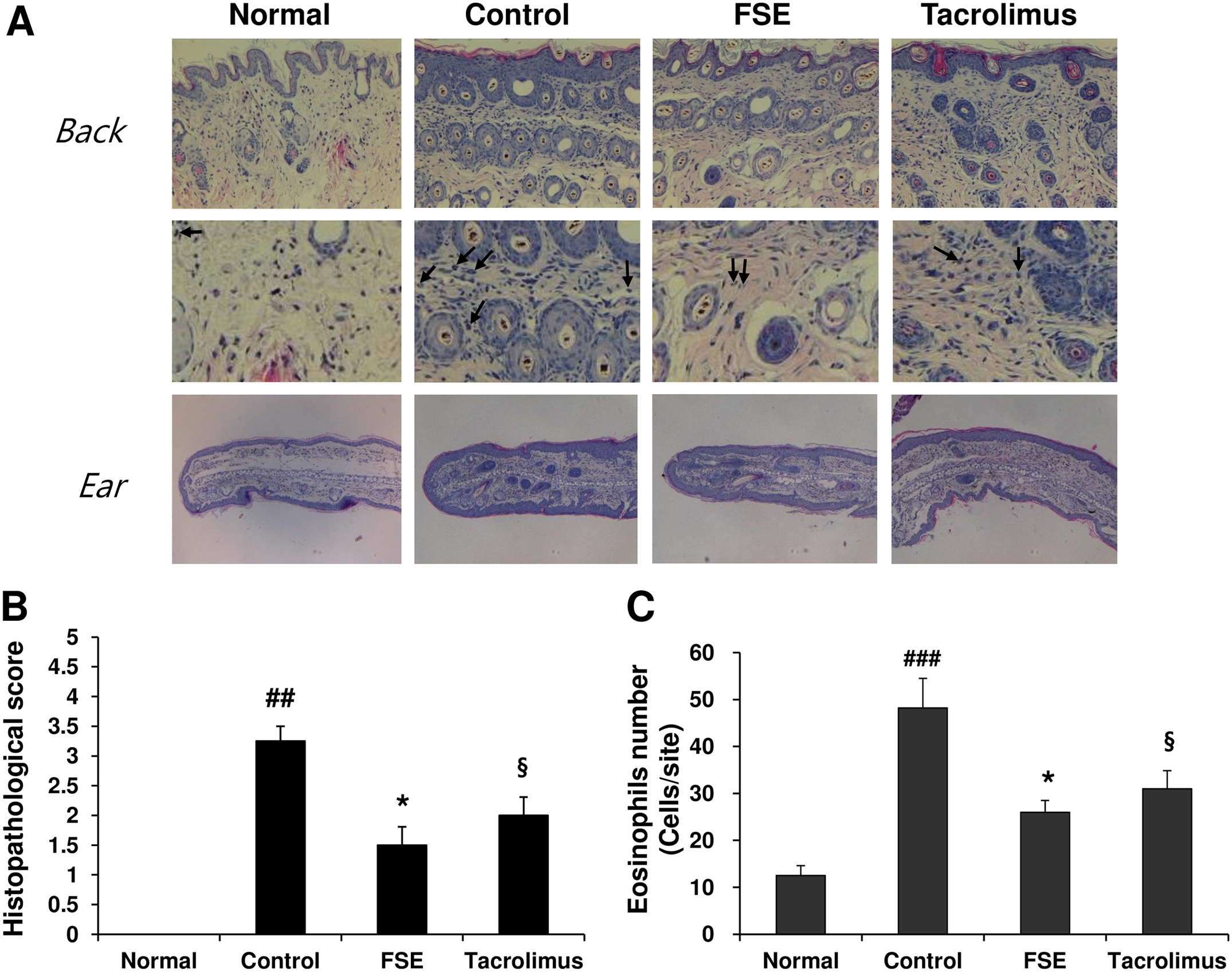 Forsythia suspensa extract reduces eosinophil infiltration and inflammation in DfE-induced atopic dermatitis in NC/Nga mouse tissue sections.